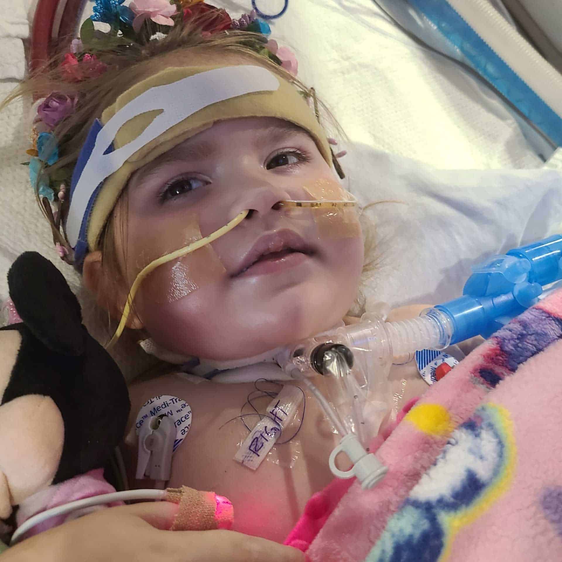 A young child with medical tubes and a nasal cannula lies in a hospital bed, wearing a headband adorned with flowers. The child holds a Mickey Mouse plush toy and is covered with a pink blanket.